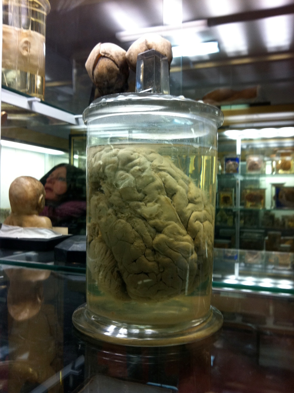 Monsieur-Tans-brain-Museue-Dupuytren-Parigi